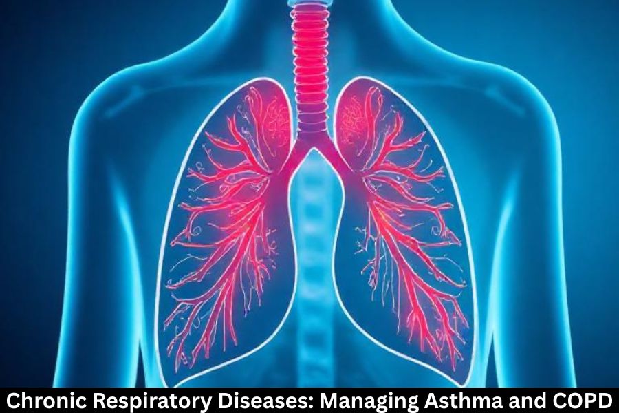 Chronic Respiratory Diseases: Managing Asthma and COPD